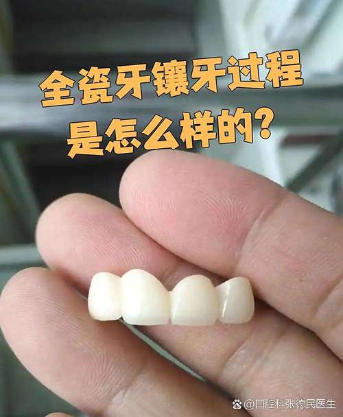 烤瓷冠能配合正畸治疗吗？-图1