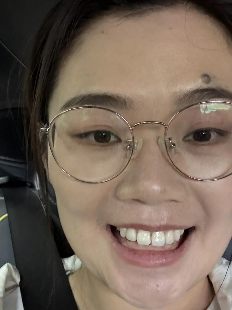 正畸治疗会导致牙根吸收吗?-图3 正畸治疗会导致牙根吸收吗?-图3