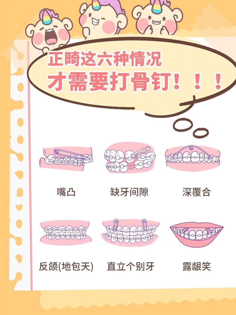 正畸结扎钉的作用有哪些？矫正效果如何？-图2