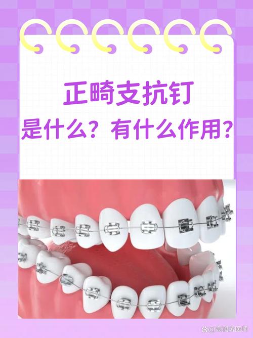 正畸结扎钉的作用有哪些？矫正效果如何？-图3