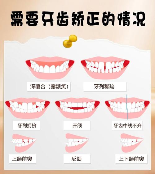 正畸临床常见问题有哪些？医生如何解答？-图3