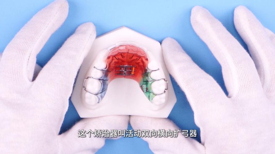 正畸舌簧加力部位-图2 正畸舌簧加力部位-图2