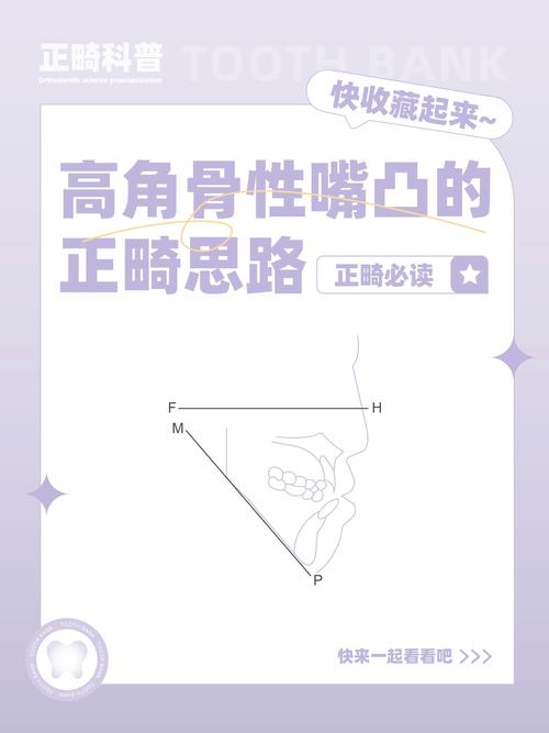 正畸调中线有哪些方法？如何精准调整与保持效果？-图2