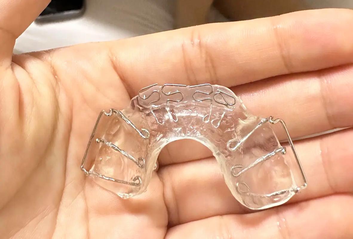 正畸个性化定制，如何根据个体差异定制？效果真的更好吗？-图3