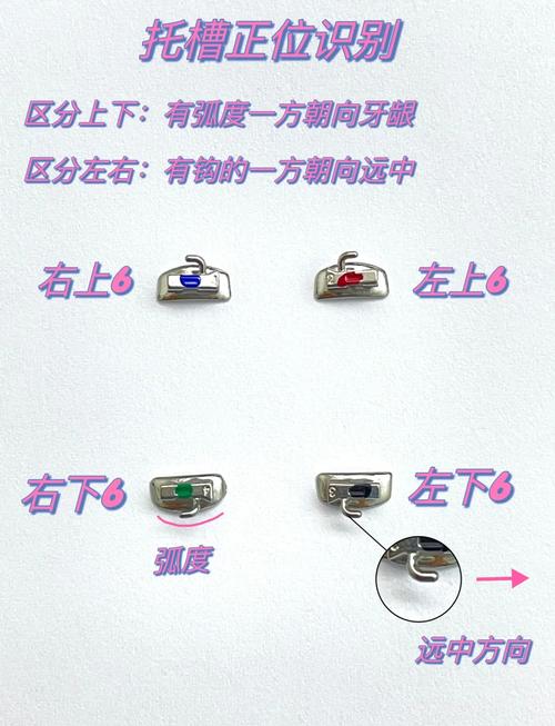 正畸托槽怎么弄掉？有哪些取下方法？-图1