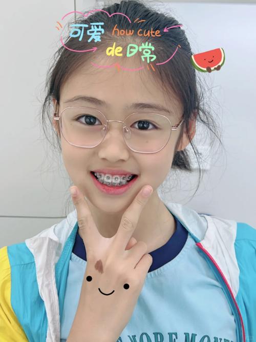 宁波好的儿童正畸-图2