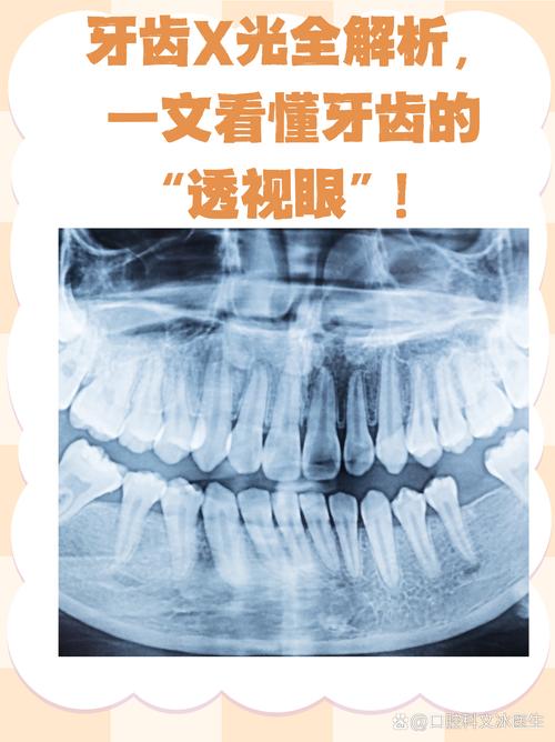 牙齿正畸x光变化-图1