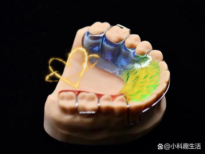 正畸平面导板制作的流程、材料及注意事项有哪些?-图2 正畸平面导板制作的流程、材料及注意事项有哪些?-图2