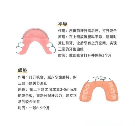 正畸平面导板制作的流程、材料及注意事项有哪些?-图1 正畸平面导板制作的流程、材料及注意事项有哪些?-图1