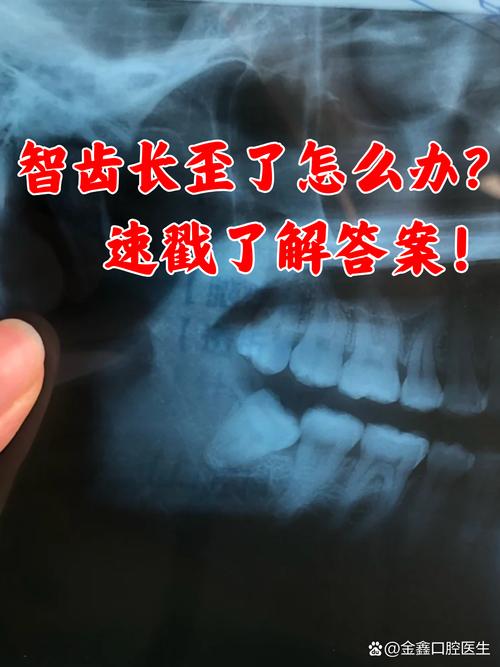 正畸后智齿冒头？原因何在？如何应对？-图2
