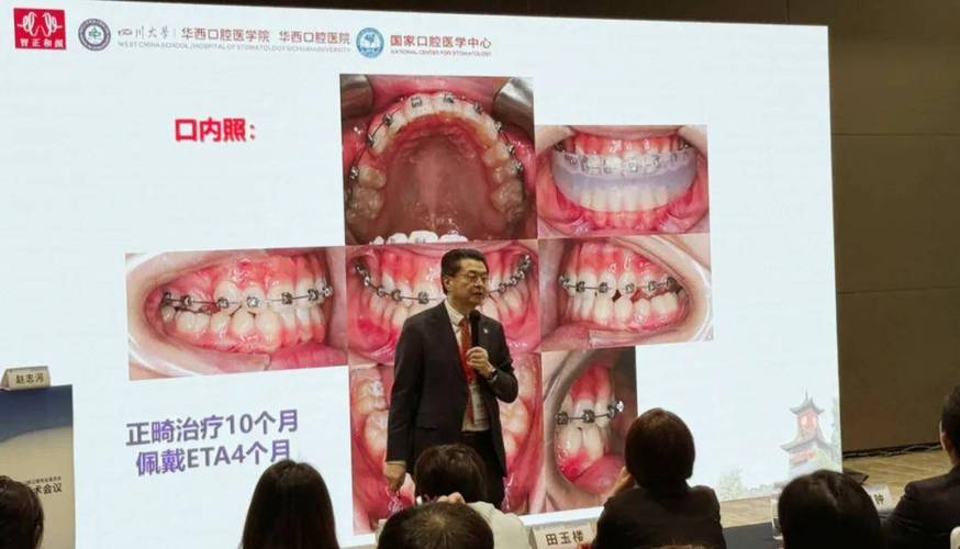 2025口腔正畸-图1