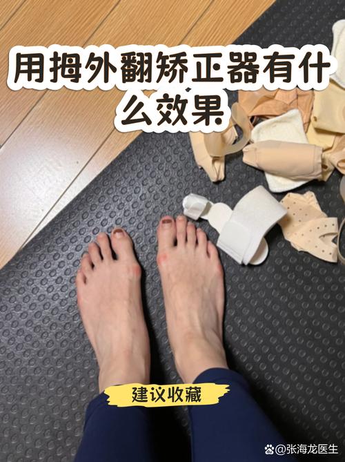 正畸对关节的压力-图1