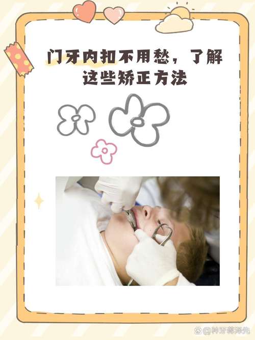 正畸内收过多怎办-图2 正畸内收过多怎办-图2