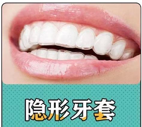 透明牙套正畸试戴-图1