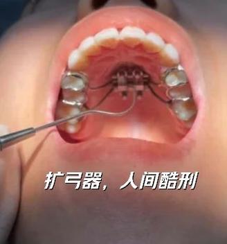 南京口腔正畸挂号-图1