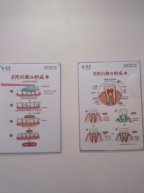 正畸寄存膜的作用机制和临床应用价值是什么?-图2 正畸寄存膜的作用机制和临床应用价值是什么?-图2