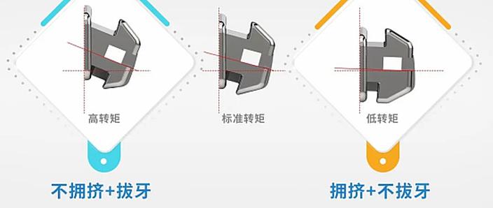 什么时正畸的转矩-图1