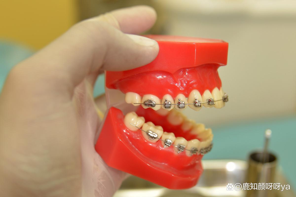 重庆拜博牙齿正畸效果如何？价格与医生技术靠谱吗？-图1