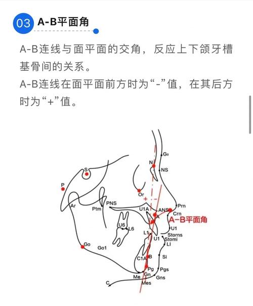 美国正畸头影测量如何精准辅助正畸诊疗？-图2