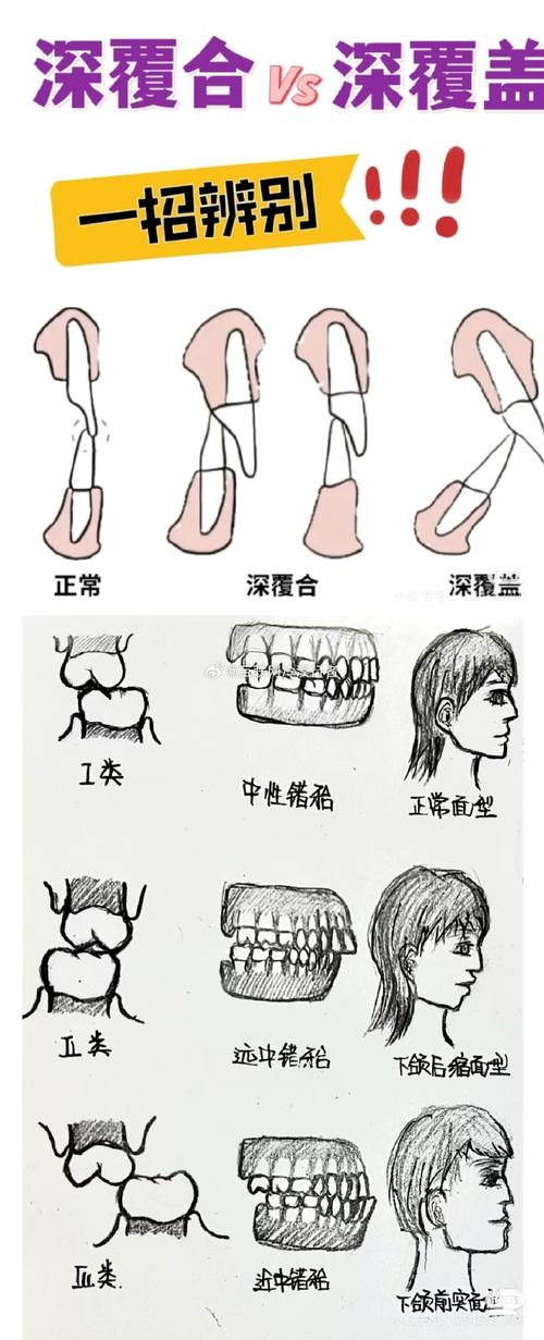 正畸治疗如何通过面部美学分析优化面部美观效果？-图2