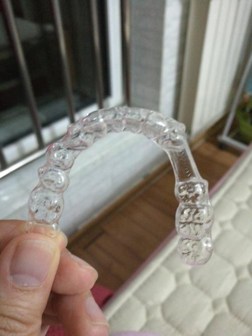 KQ88隐形正畸效果如何？适合哪些人群做呢？-图2