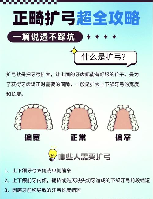 正畸固定扩弓病例的临床关键点有哪些？-图3