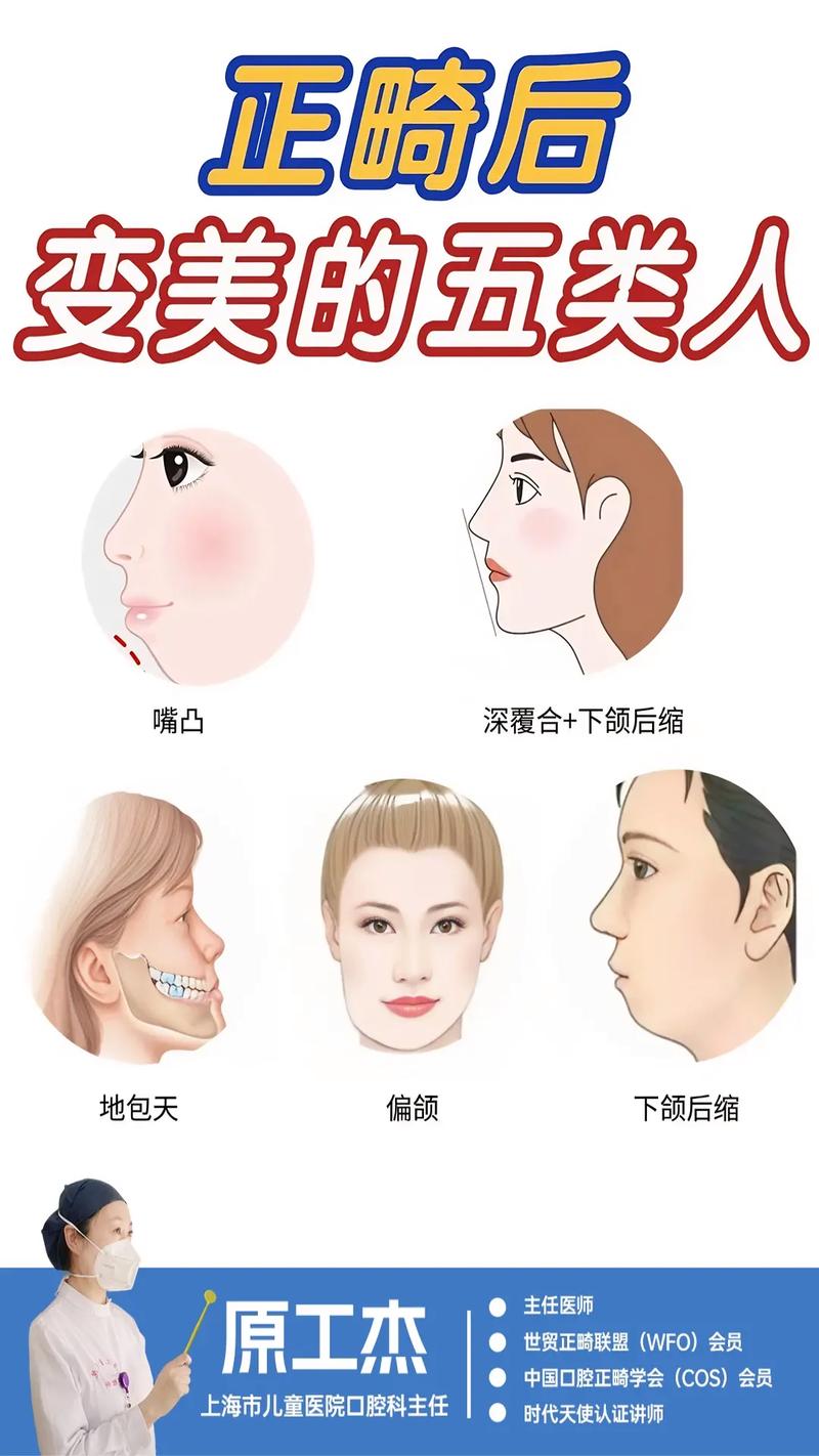 正畸中期变成开颌-图2