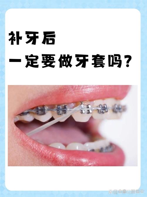正畸前必须补牙吗-图1