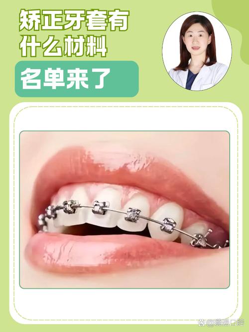 正畸牙套材质有哪些？哪种更适合你的正畸需求？-图2