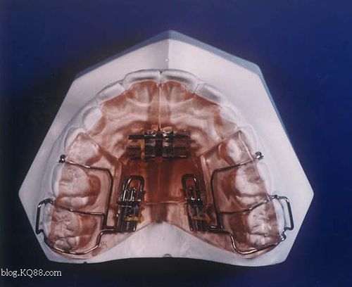 正畸入门要注意什么？新手必看指南有哪些？-图3