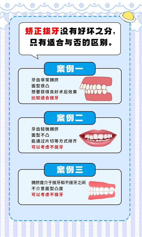 正畸拔牙矫正教学-图1