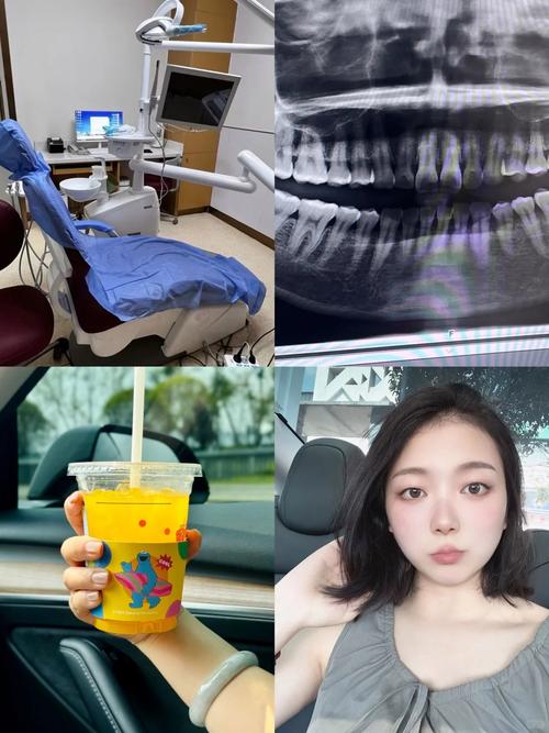 正畸可以拍牙片吗-图2