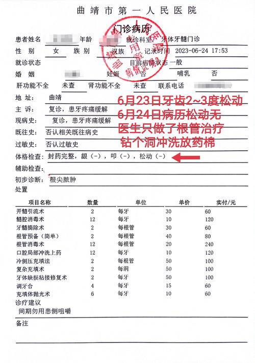 正畸转拔牙病例，为何需转拔牙？适应症解析？-图3