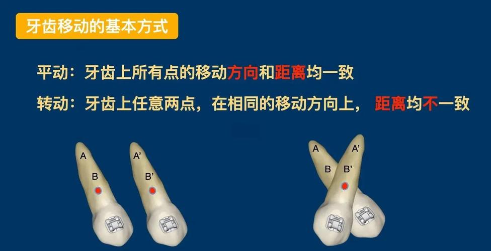 正畸中牙根的移动-图1