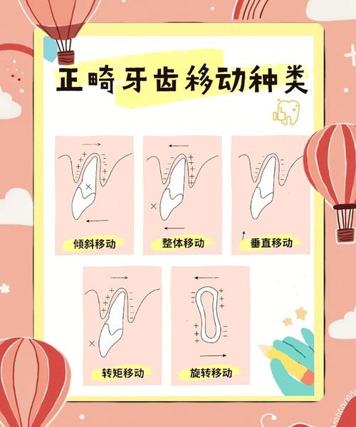 正畸中牙根的移动-图2