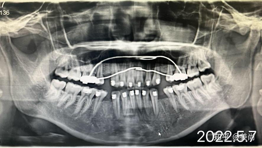 口腔正畸X光检查-图1