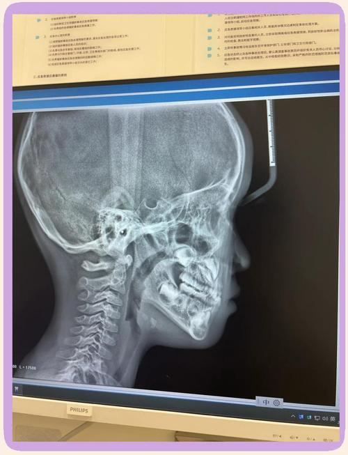 口腔正畸X光检查-图2