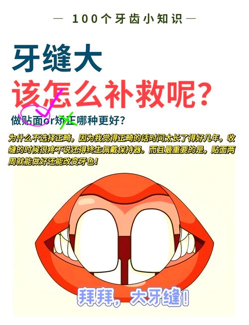 牙缝大正畸的方法-图1