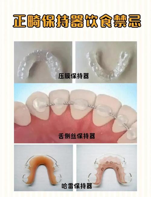 正畸中保持阶段的具体含义是什么？-图1
