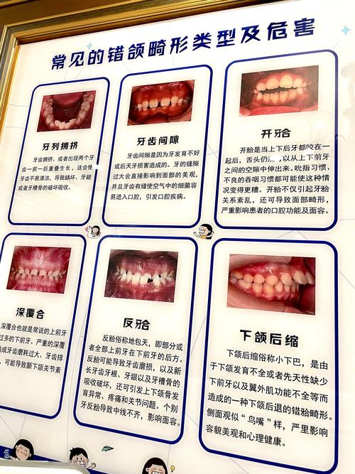 anb正畸正常值-图2