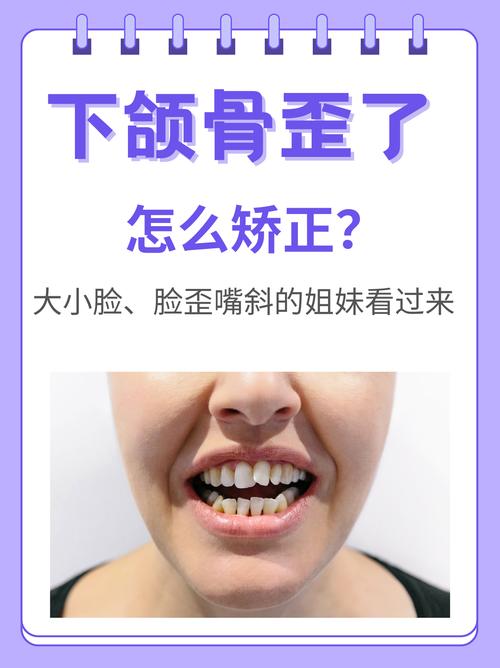 正畸张嘴下巴歪了-图2