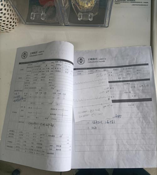 牙齿开合正畸病例-图1