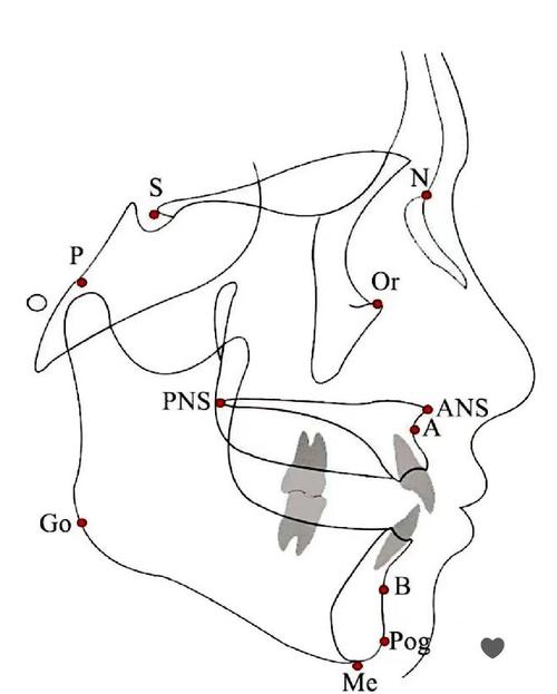 正畸治疗中头影测量如何正确操作与解读？-图2