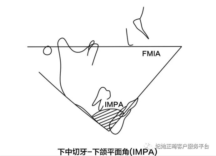 正畸治疗中头影测量如何正确操作与解读？-图3