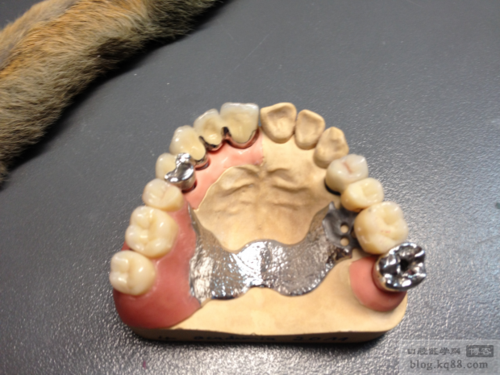 吴江口腔正畸支架矫正效果如何？安全吗？怎么选？-图1