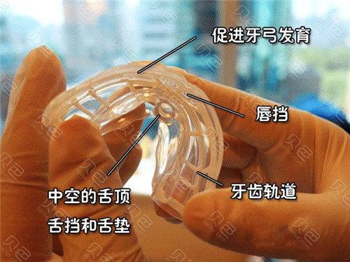 预防性正畸ETA-图3