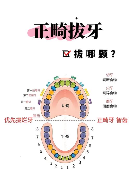牙齿正畸在哪里看-图2