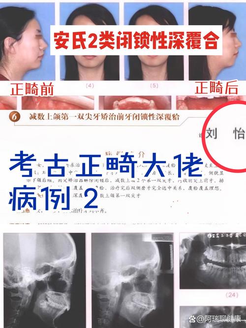 周医生正畸案例集藏着哪些牙齿矫正成功秘诀吗？-图2
