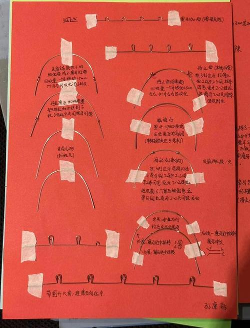 正畸弓丝转矩度数如何精准选择以实现牙齿理想移动?-图2 正畸弓丝转矩度数如何精准选择以实现牙齿理想移动?-图2