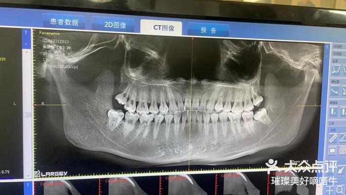 口腔正畸X光片有何关键作用？-图1